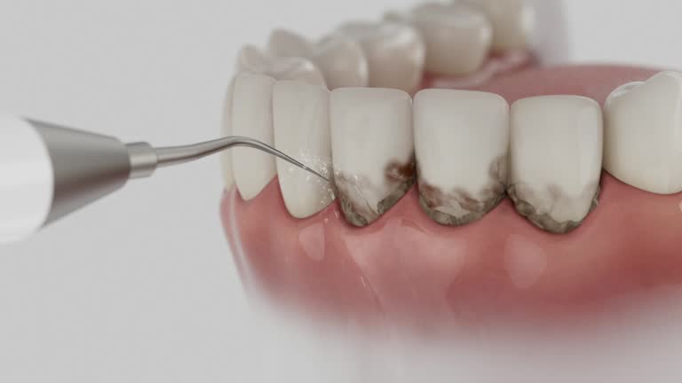 Reliable Dental Crowns And Bridges contractor in Butte County County, ID by Dentist Open Now